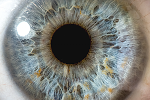 benefits of iridology